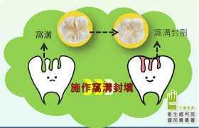 2.衛服部封填照片